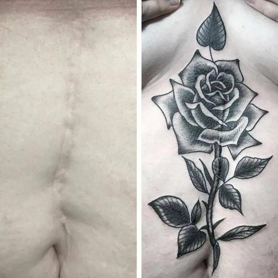 Тату на шрамах на руке для девушек. Наколки для девочек. Тату на теле девушек маленькие. Девочки делают татушку. Девушка скрывает татуировку.