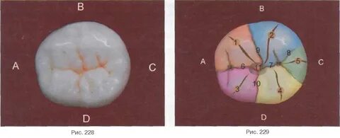 Фиссуры зубов схема
