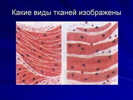 Какие ткани можно определить