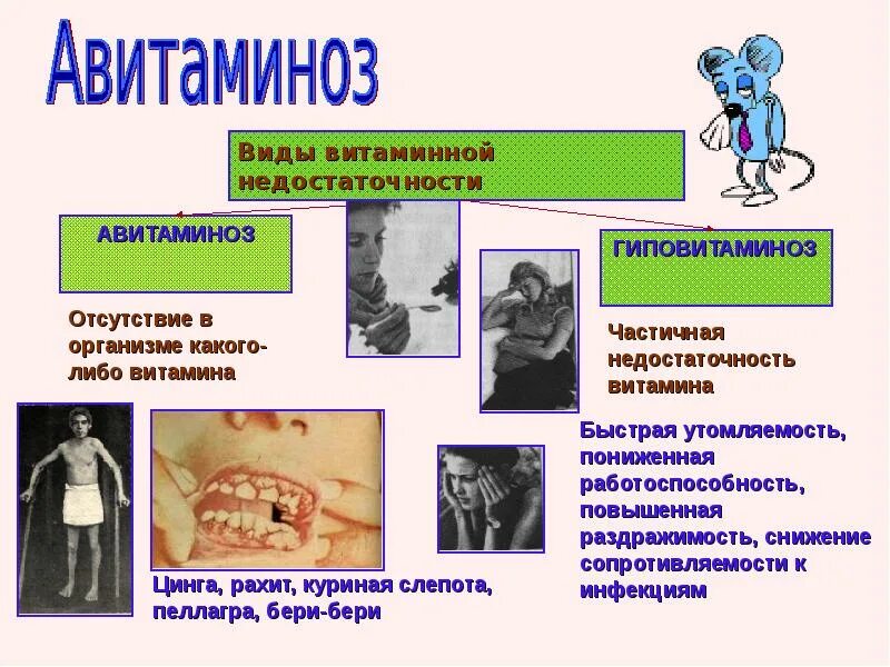 Авитаминоз витамина с приводит. Куриная слепота (дефицит витамина а). Авмитомиозм витамина д. Авитаминоз витамина с приводит. Цинга (дефицит витамина с).