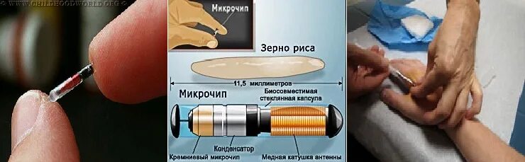 Почему подсаживают. Чипирование людей в России.