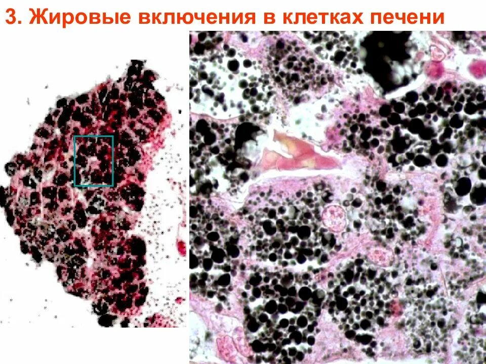 Клетки печени крыс. Включения жира в клетках печени аксолотля. Жировые включения препарат гистология. Жировые включения в клетках печени гистология препарат. Жировые включения в клетках печени окраска осмиевая кислота.