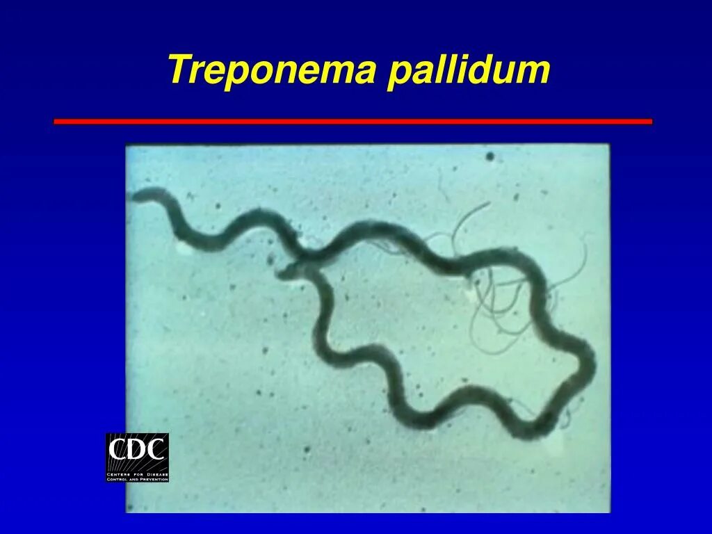 Бледная трепонема treponema pallidum. Спирохеты трепонемы сифилиса. Трепонема паллидум морфология. Спирохета бледная трепонема.