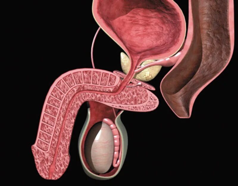 Мужской половой орган. Хронический застойный простатит. Заболевания мужских половых органов. Простатоцистит