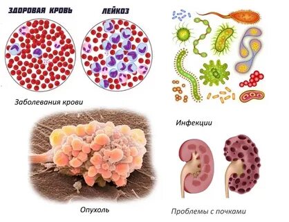 Что значит инфекция