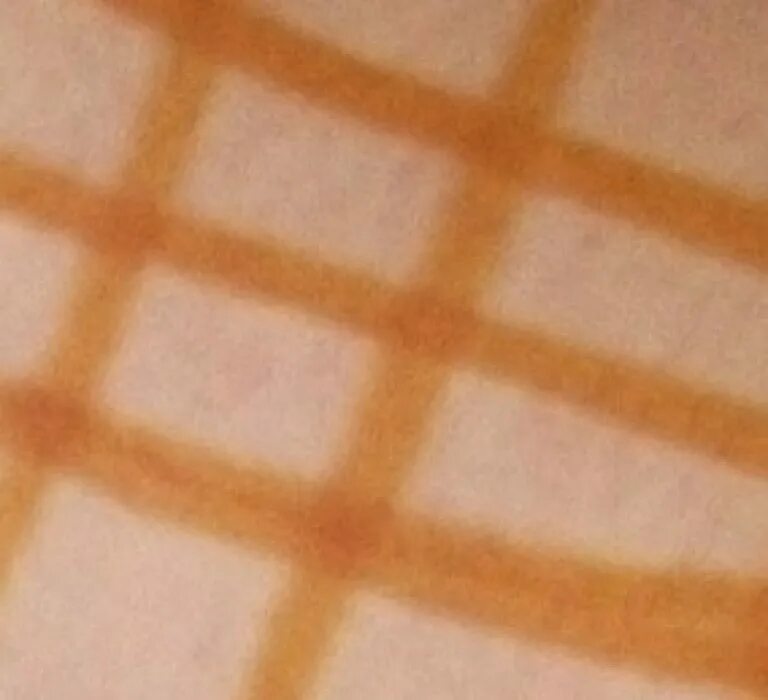 Йодовая сетка для похудения. Можно ли делать йодовую сетку на горло. Можно ли делать йодовую сетку на горло. Можно ли делать йодовую сетку на горло. Йодовая.