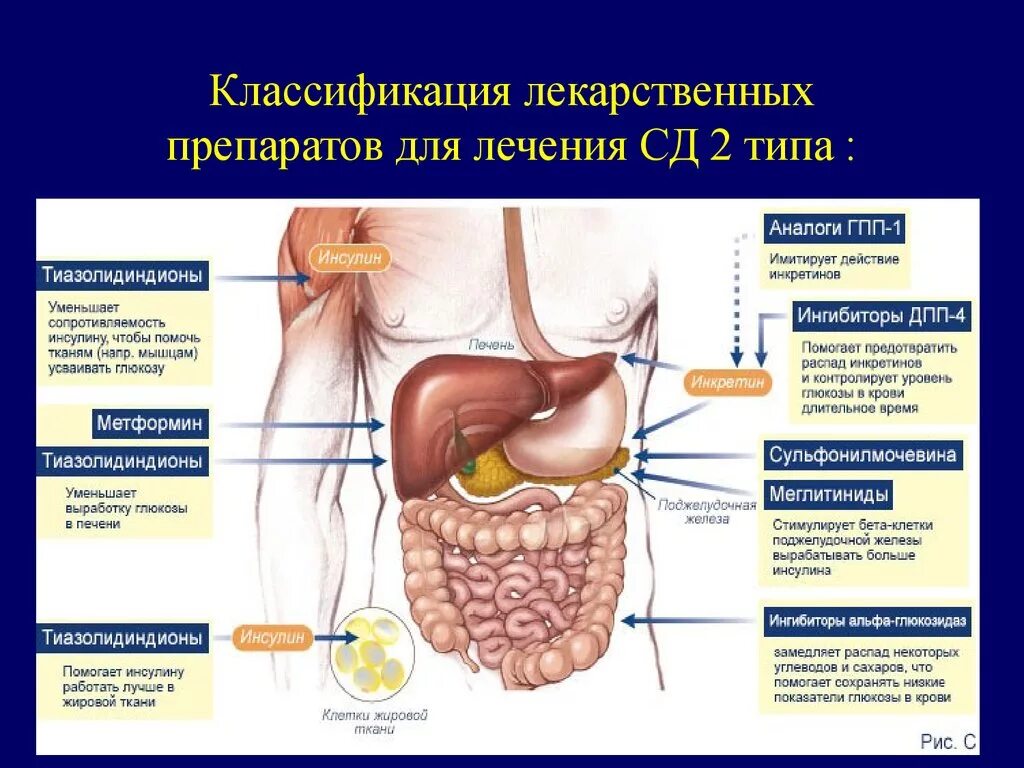 Классификация СД 2. Лечение СД 2 типа. СД 2 типа препараты классификация. Классификация сахарного диабета 2 типа.