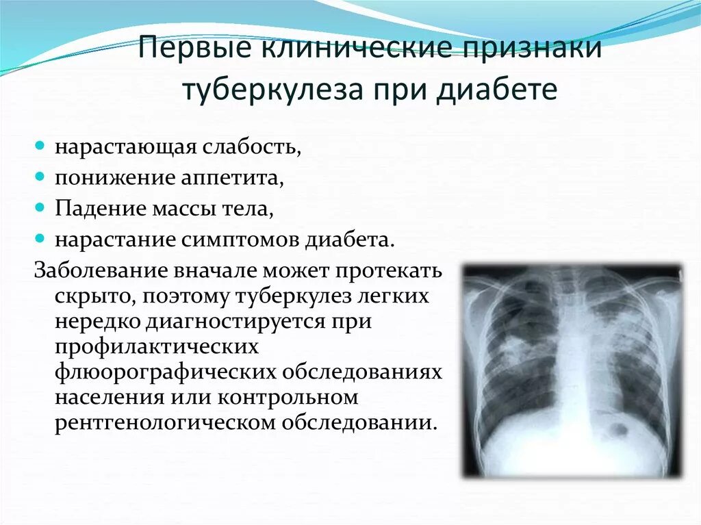 Туберкулез можно ли мочить. Ранние признаки туберкулеза. Симптомы поражения легких при туберкулезе. Ранними симптомами туберкулеза являются. Клинические признаки начала туберкулеза..