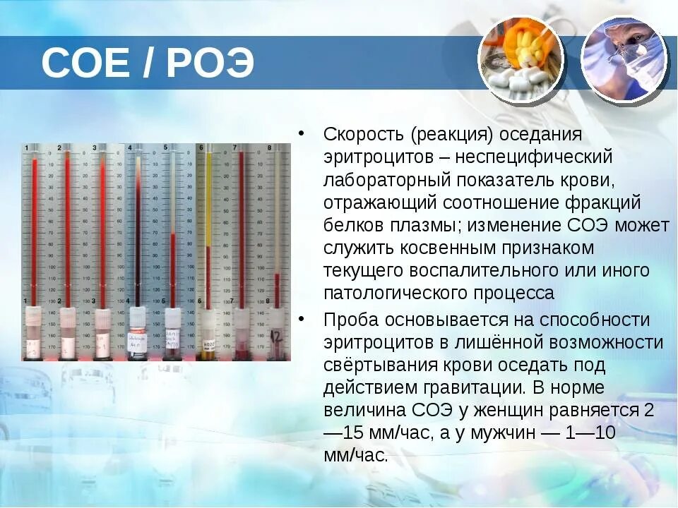 Соэ 37 у женщины что. Скорость оседания соэ норма. показатели соэ в крови норма. соэ 60. скорость оседания эритроцитов соэ повышена.