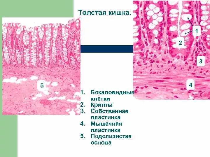 Клетки толстой кишки