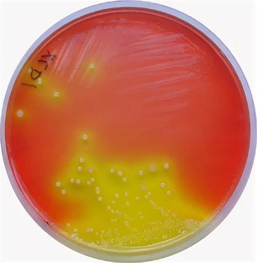 Staphylococcus aureus среда. Агар XLD Shigella. Сальмонелла на XLD агаре. XLD агар шигелла. Шигелла на XLD.