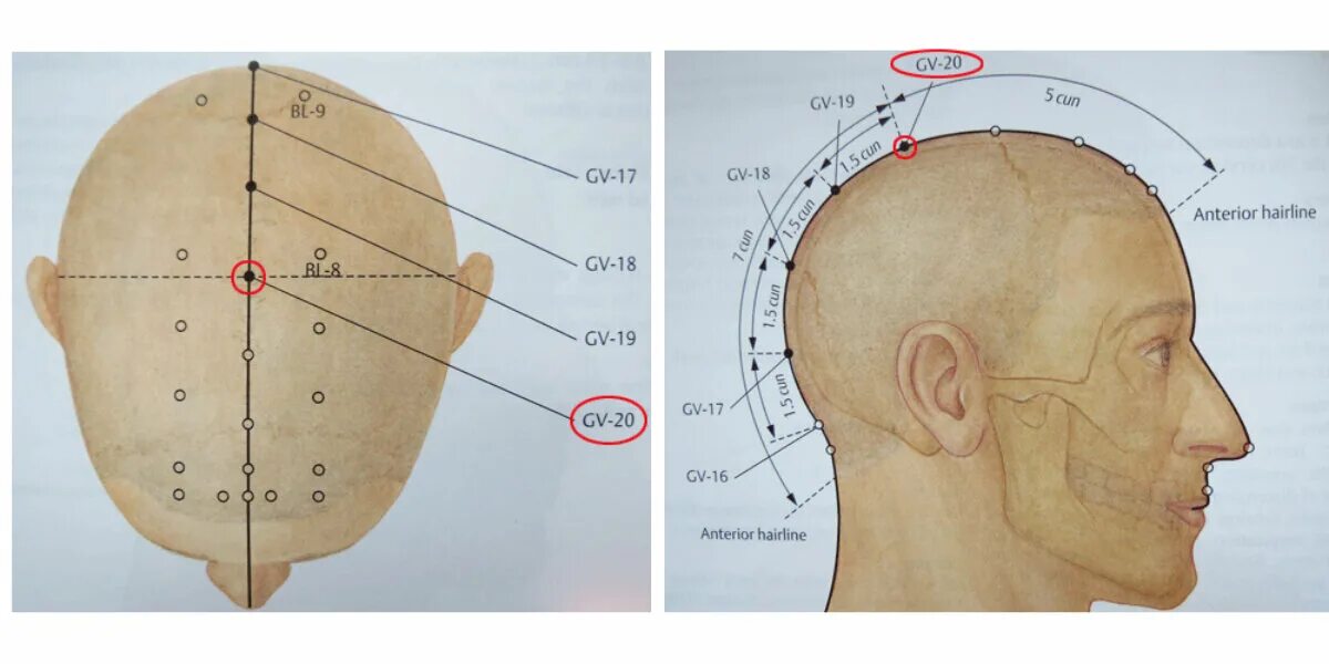 Точка бай Хуэй макушка. Акупунктура VG 20 бай Хуэй. Vg20 точка акупунктуры. Точка на макушке головы бай Хуэй. 20 20 точка рф