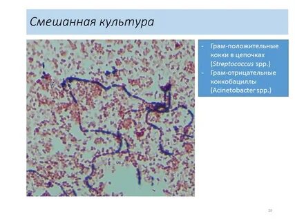 Окраска бактерий по граму