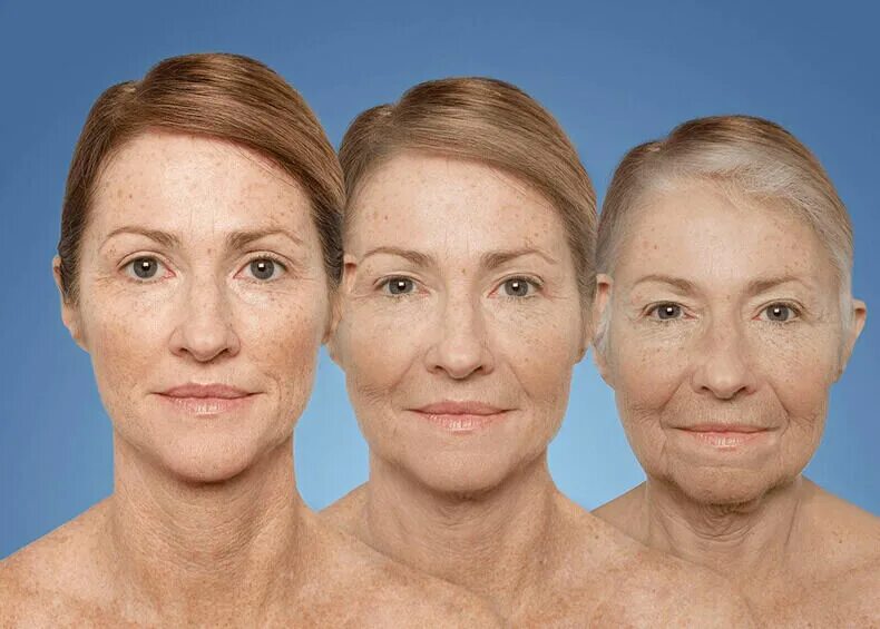 Возраст человека 25 30 лет. Возрастные изменения кожи. Женщины разных возрастов. Возрастные изменения лица. Старение лица женщины.