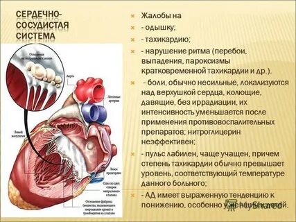 Ревматизм сердца
