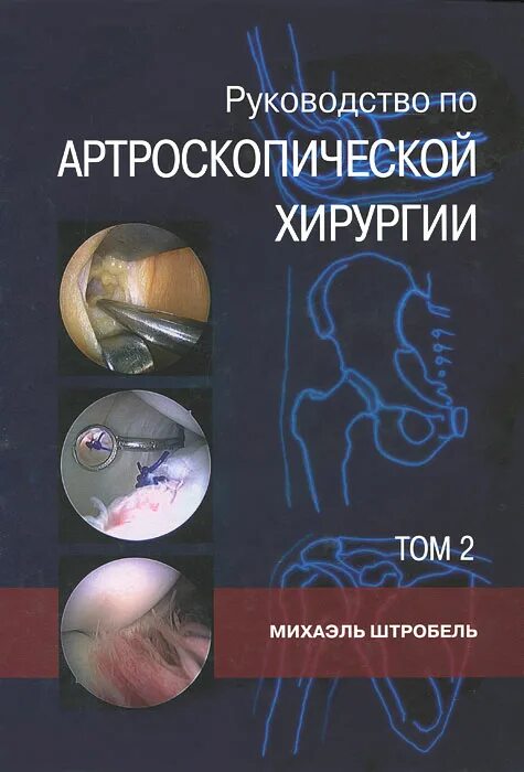 Купить книгу хирургия. Руководство по артроскопической хирургии том 2 Штробель Михаэль. Руководство по артроскопической хирургии Михаэль Штробель. Том-1. Руководство по хирургии. Книга по артроскопии Штробель.