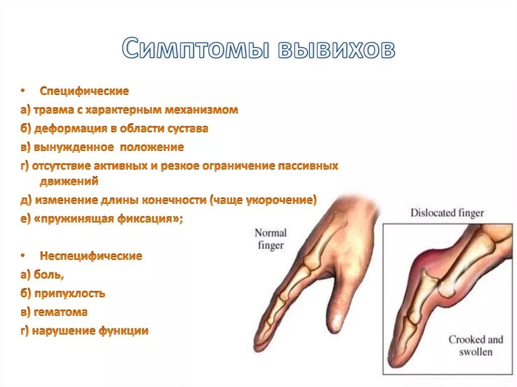 Симптом характерный для вывиха. Вывихи суставов характерные признаки. Основные симптомы вывиха.