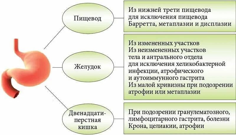 Гастрит повышенная кислотность. Симптомы при повышенной кислотности желудка. Желудок с повышенной кислотностью. Повышенное кислотообразование в желудке. Восстановить желудок при гастрите