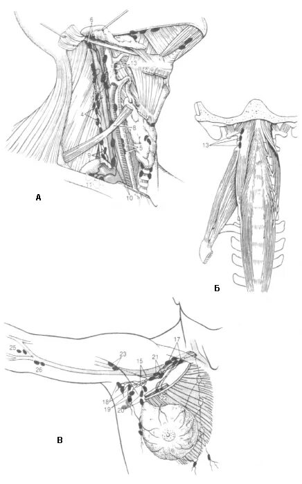 Претрахеальные лимфатические узлы. Лимфатические узлы 1 анатомическая зона. Паратрахеальные лимфатические узлы. Подчревные лимфатические узлы. Поясничные лимфоузлы