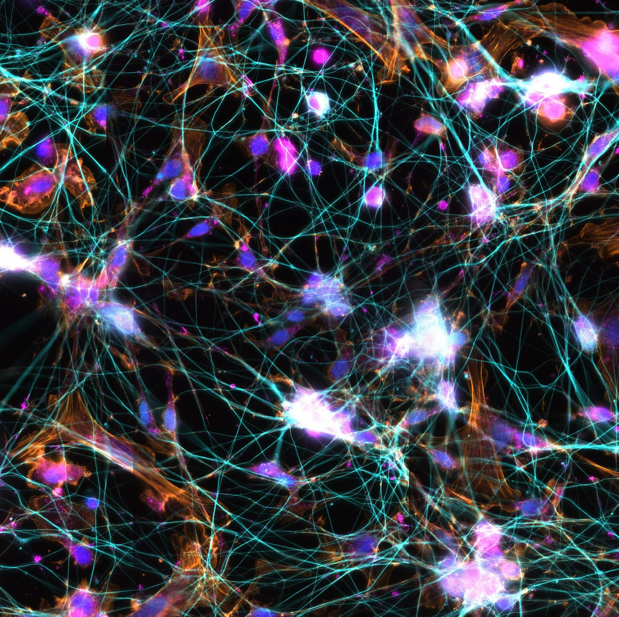 Нейронные боеприпасы. Нейронные связи. Нейронная сеть. Нейронная сеть мозга. Нейронные связи головного мозга.