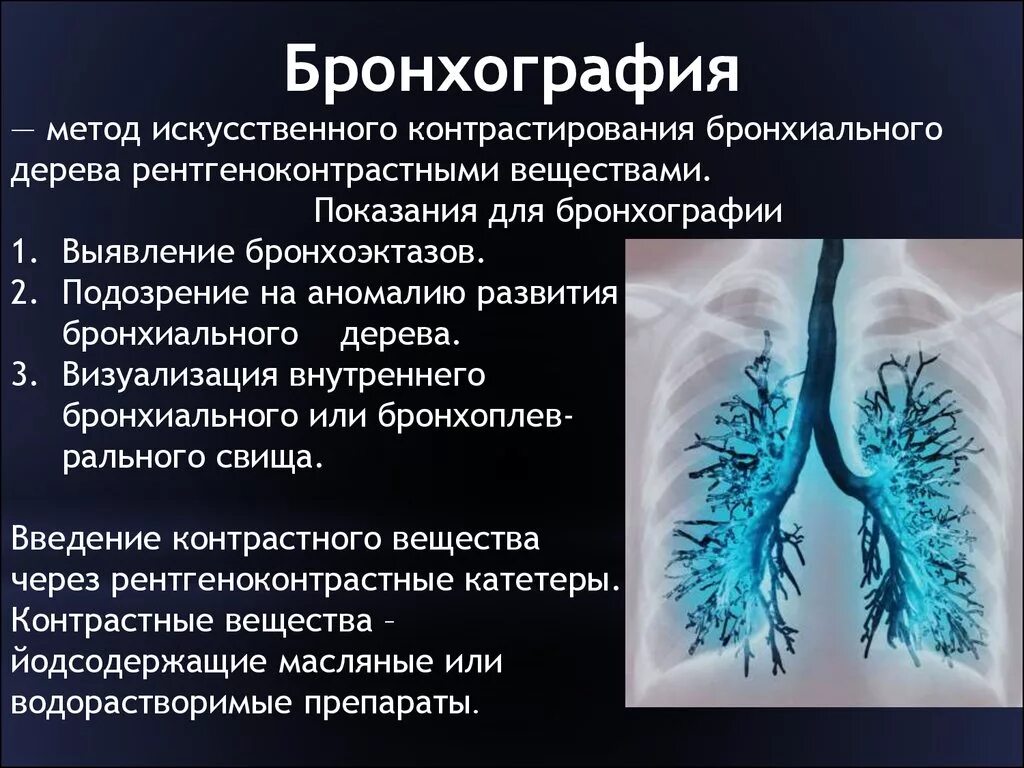 Бронхиальная болезнь легких. Бронхография методика проведения. Бронхография метод исследования. Бронхоэктатическая болезнь бронхография.