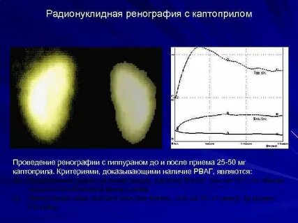 Ренография