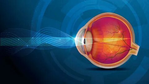 Glaucoma