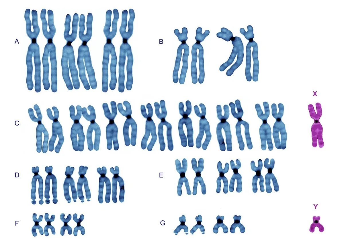 Хромосома на белом фоне. XY хромосомы. Хромосомы человека ФРАГМЕНТЫ. Хромосомы картинки. Парные одинаковые хромосомы