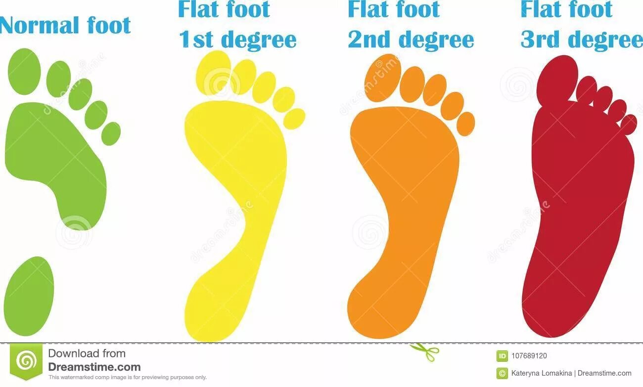 Normal feet