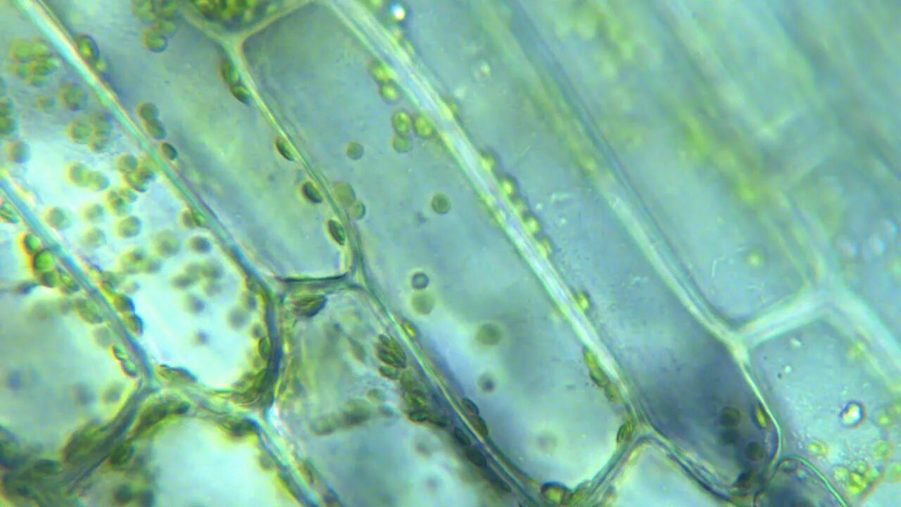Органоид водоросли. Хлоропласты элодеи. Хлоропласт микрофотография. Клетка растения Элодея. Хлоропласты в клетках элодеи.