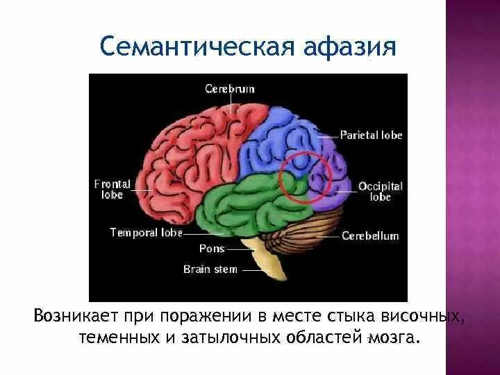Акустико семантической афазии. Семантическая афазия очаг поражения. семантическая афазия симптомы. акустико семантическая афазия. семантическая афазия зона поражения.