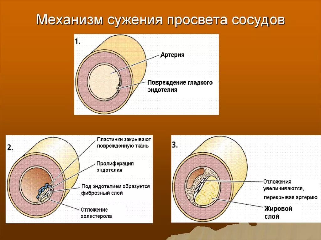 Кольцевой слой. Просвет кровеносных сосудов. Увеличение просвета кровеносных сосудов. Уменьшение просвета сосудов. Сужение кровеносных сосудов.