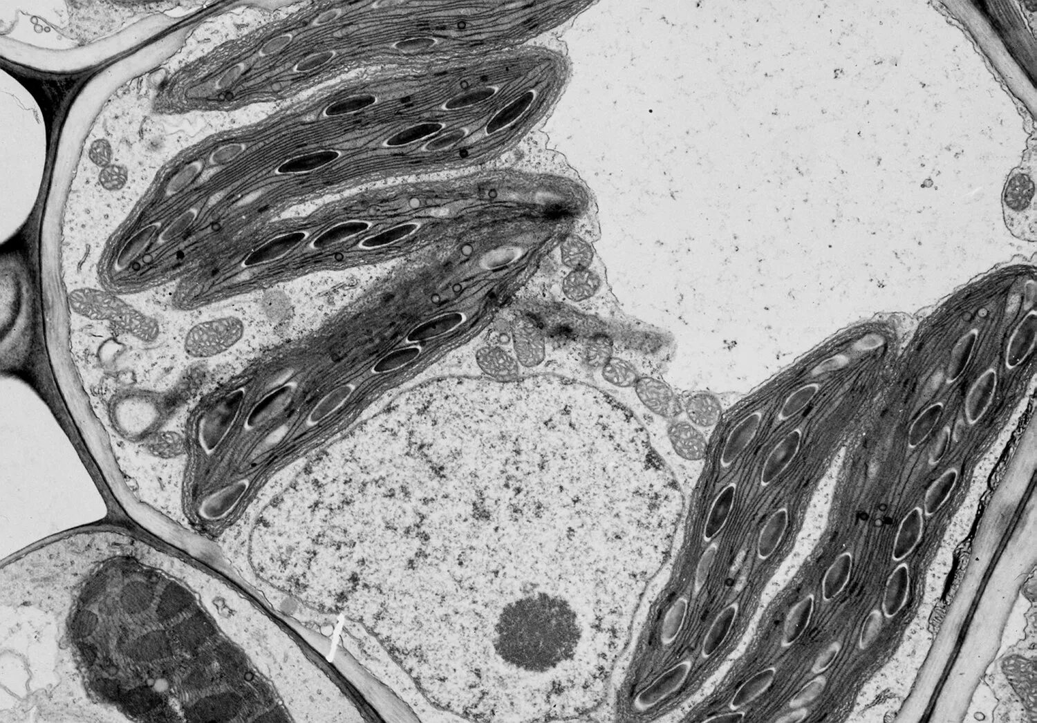 ядрышко ядра в растительной клетке микроскоп. цитоплазма микрофотография. электронограмма митохондрии. цитоплазма микрофотография. цитоплазма клетки микрофотография.