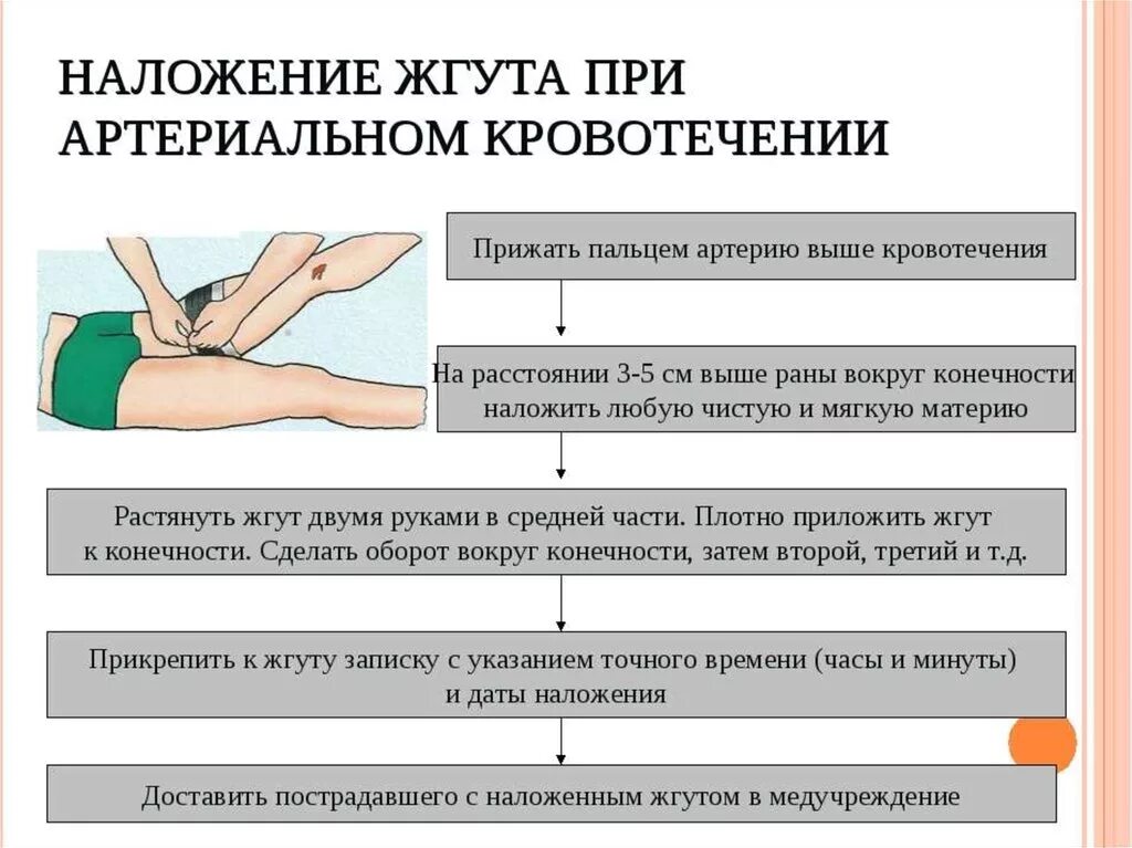 Порядок наложения жгута при артериальном кровотечении. При правильном наложении жгута для остановки кровотечения:. Накладывание жгута при кровотечении порядок. Результатом правильного наложения жгута при кровотечении является. Алгоритм наложения жгута при артериальном кровотечении