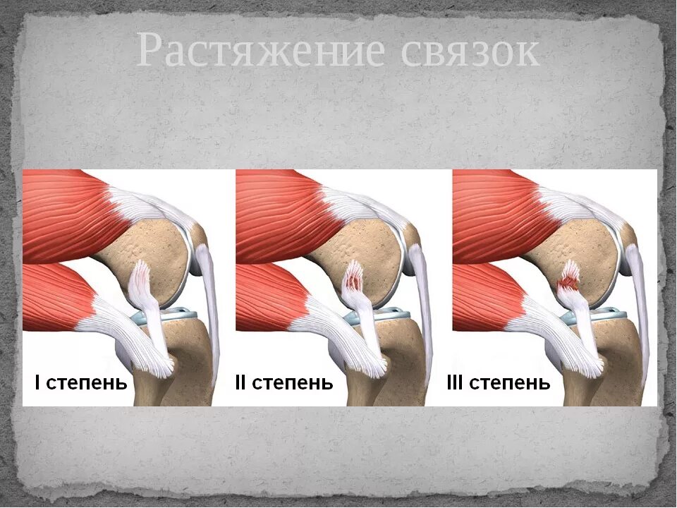 Растяжение рисунок