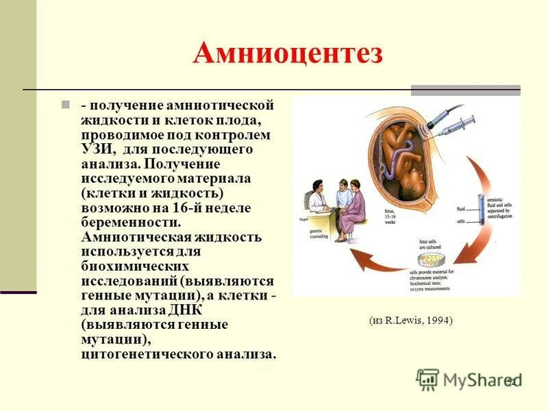 исследование амниотической жидкости. анализ амниотической жидкости. анализ амниотической жидкости. методы исследования генетики человека биохимический метод. жидкость амниотической жидкости.