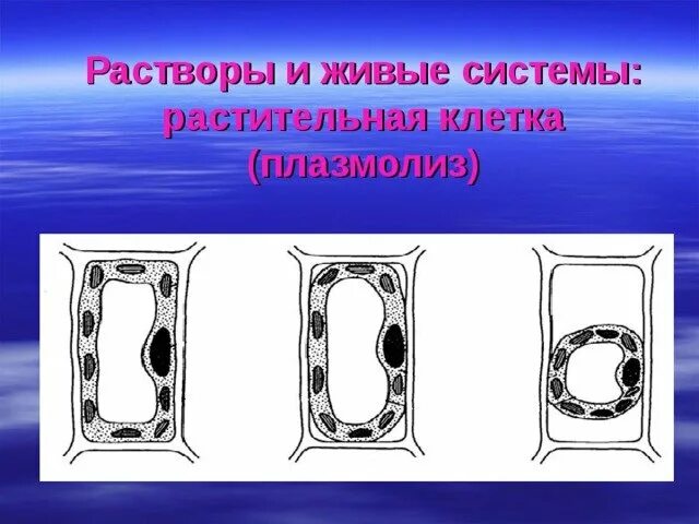 Наблюдение плазмолиза. Тургор плазмолиз деплазмолиз. Типы плазмолиза растительной клетки. Плазмолиз растительной клетки рисунок.