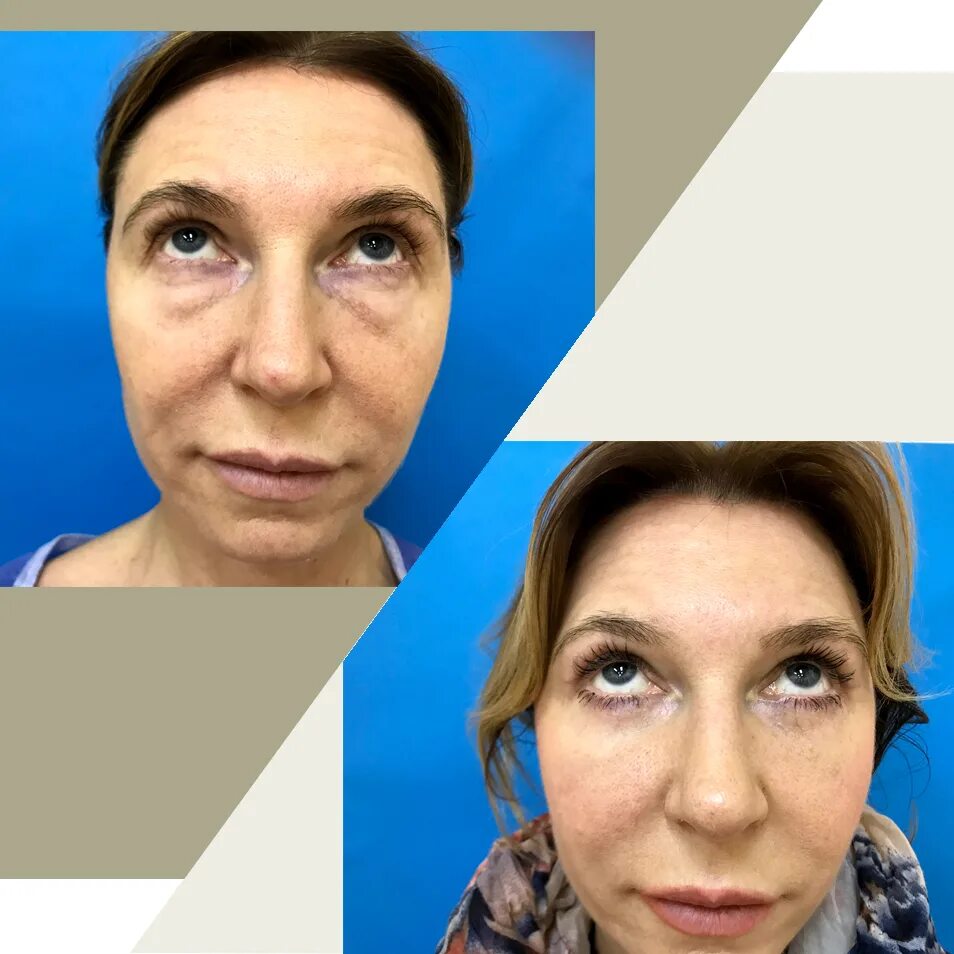 зулихан юсуповна пластический хирург. зулихан юсуповна пластический хирург. висаитова зулихан юсуповна. зулихан юсуповна пластический хирург. чкадуа тамара зурабовна пластический хирург, челюстно-лицевой хирург.