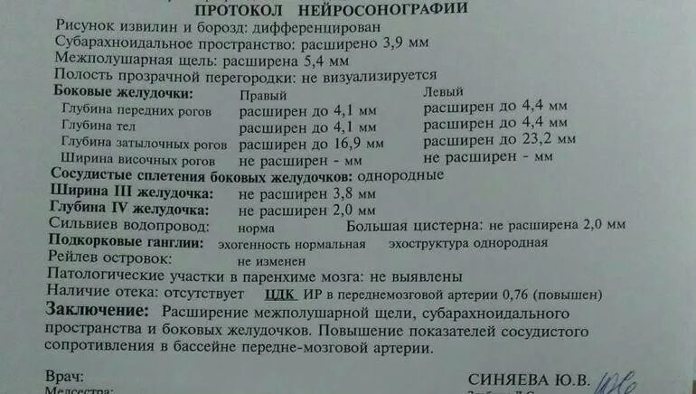 Норма субарахноидального пространства. Нейросонография головного мозга грудничка норма. узи головного мозга у новорожденных расшифровка норма таблица. узи головного мозга в 7 месяцев норма. нормы узи головного мозга у грудничка.