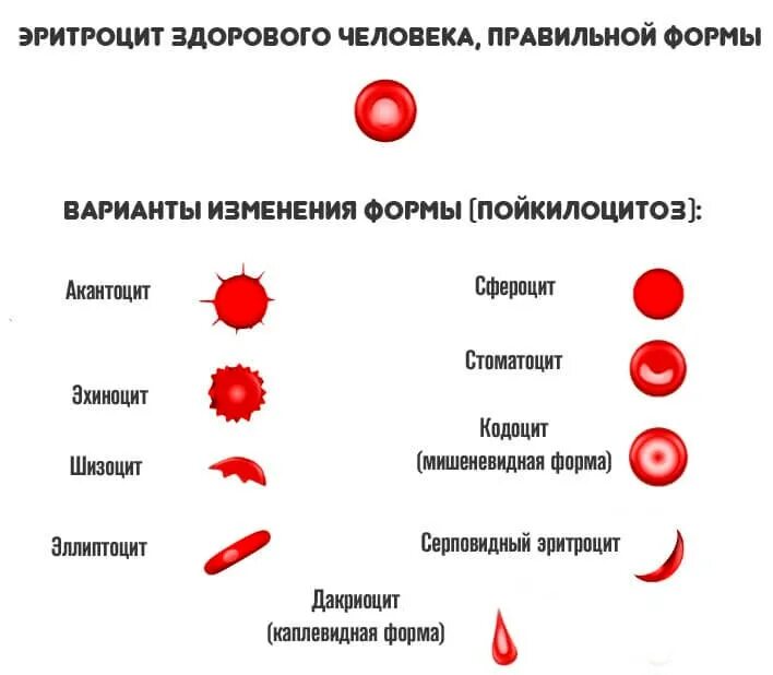 Аллергическая анемия. Эритроциты кольцевидной формы. Красные клетки крови. Патологические формы эритроцитов. Сферическая форма эритроцитов.