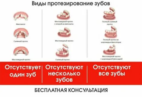 Какой вид протезирования выбрать
