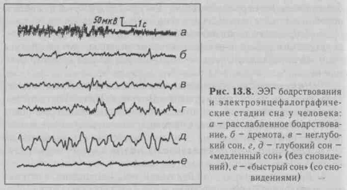 Фазы ээг. Фазы сна ээг. фазы медленного сна ээг. ээг сна и бодрствования. электроэнцефалограмма медленного сна.