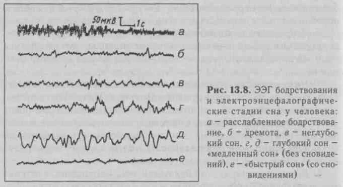 Ээг бодрствования. Фазы сна на ЭЭГ. ЭЭГ сна и бодрствования. ЭЭГ медленного сна. Спокойное бодрствование ЭЭГ.