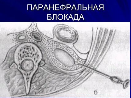Почечная блокада
