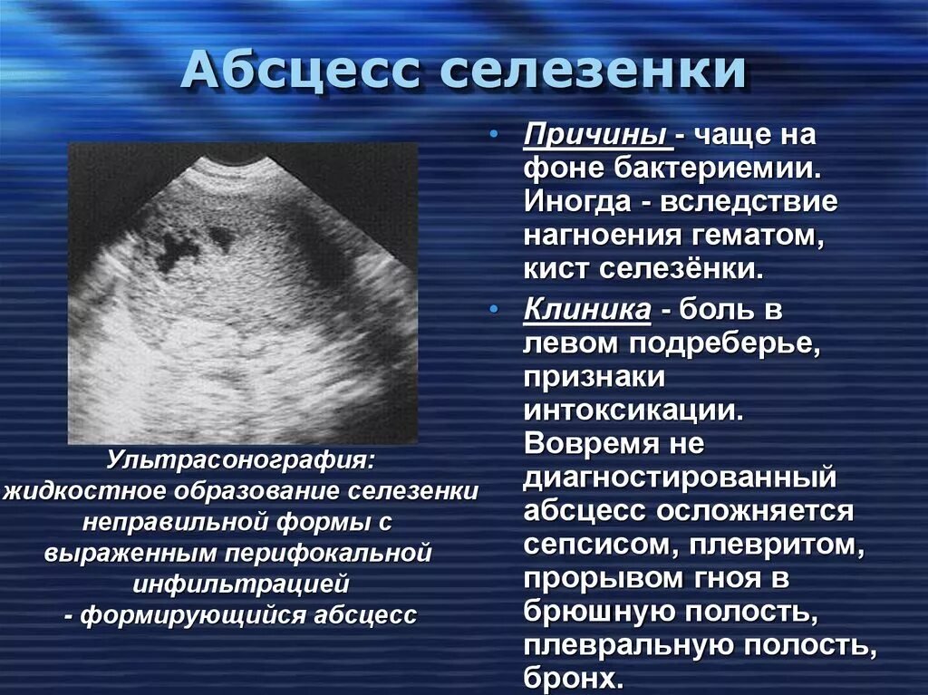 Работа селезенки. Селезёнка болит симптомы. Нарушение селезенки симптомы. Патология селезенки симптомы.