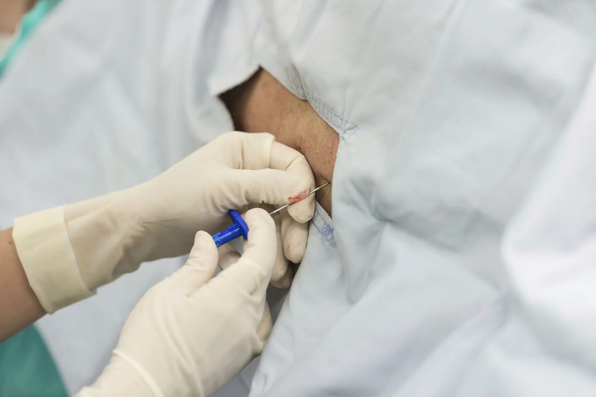 Эпидуральная анестезия собаке. Укол блокада дипроспан. Наркоз при грыже позвоночника. Наркоз при грыже позвоночника. Эпидуральная анестезия.