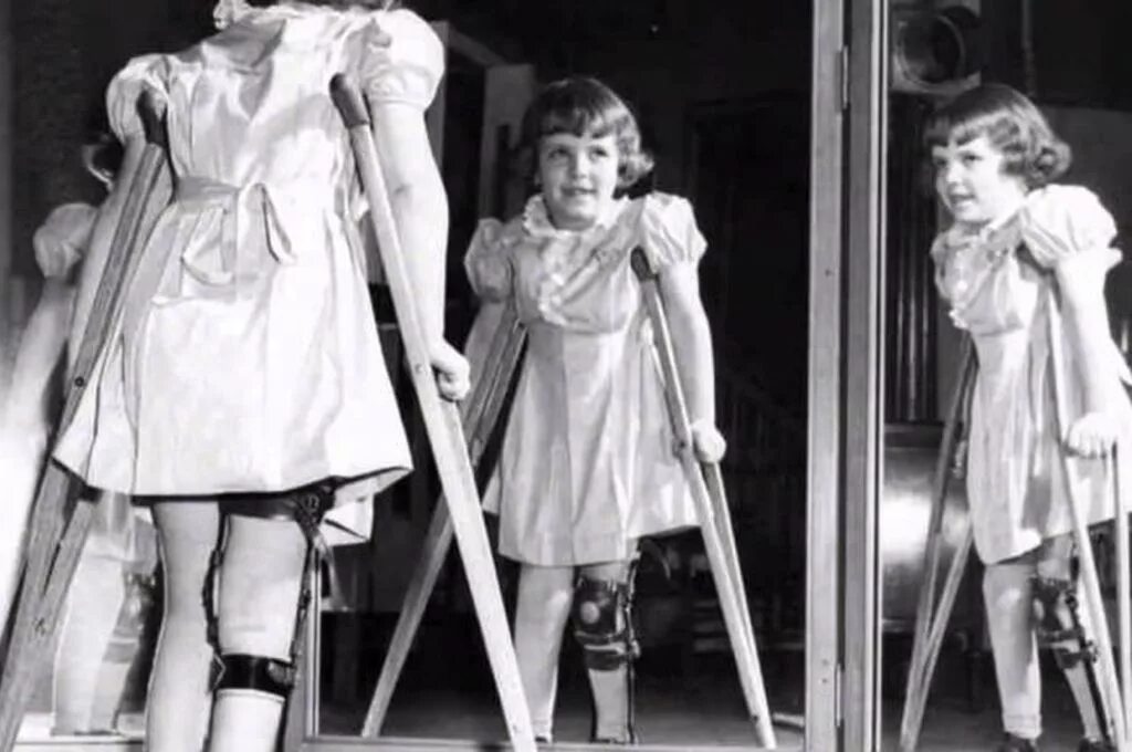 Полиомиелит смертность в россии. Эпидемия полиомиелита в сша. Джонас солк полиомиелит. Полиомиелит статистика. Вспышка полиомиелита в таджикистане.