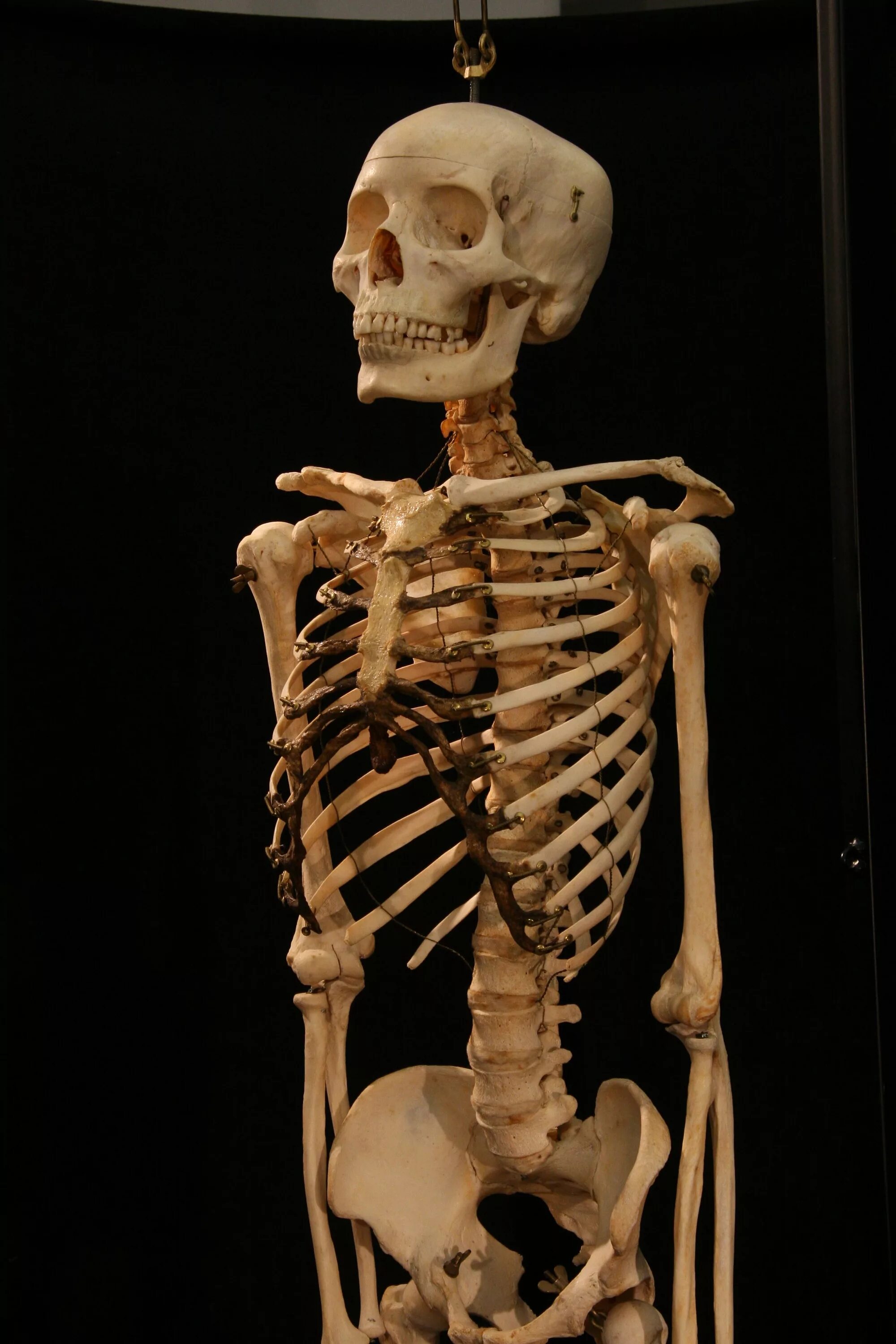 Скелет человека. Кости человека.