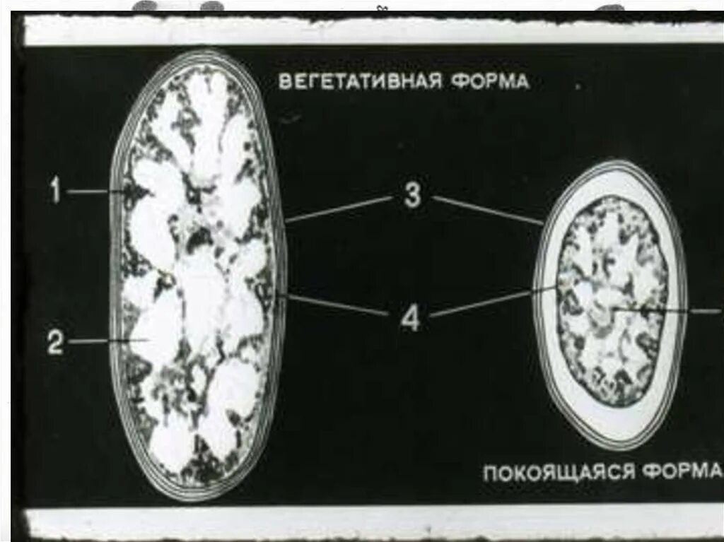 Споры и вегетативные формы. Рикеетсии провчека микроскопия. Вегетативная и покоящаяся формы риккетсий. Риккетсии строение. Ультраструктура риккетсий.