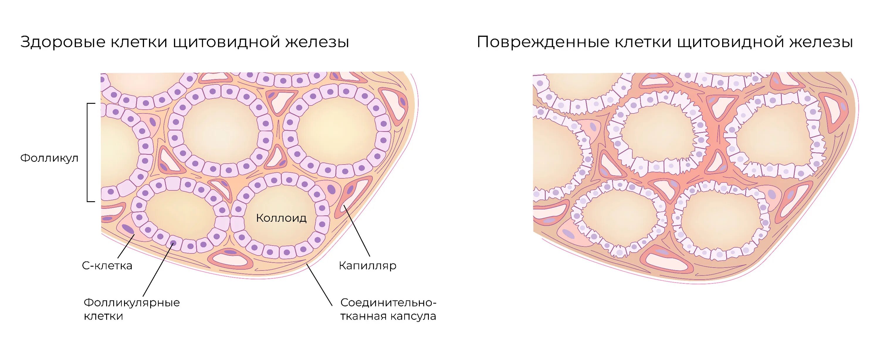 Фолликул щитовидной железы что это. Фолликулы щитовидной железы гистология. Клетки щитовидной железы гистология. Коллоид фолликулов щитовидной железы. Гипофункция щитовидной железы гистология.